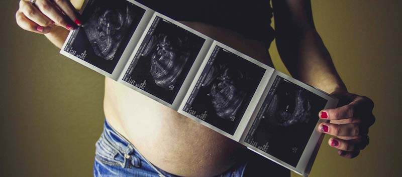 londonsono - Pregnancy Ultrasound Scan scan