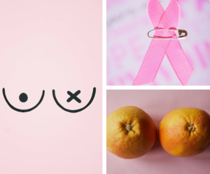 Breast Diseases