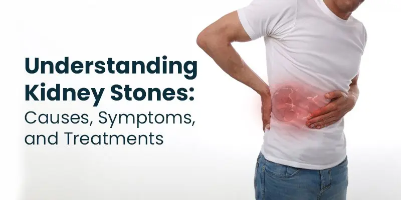 Kidney Stone Relief: Causes, Symptoms, and Treatment