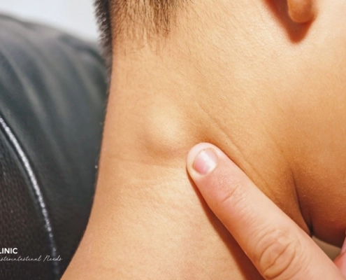 lumps and Bumps, MSK services for lump on the neck as pictured