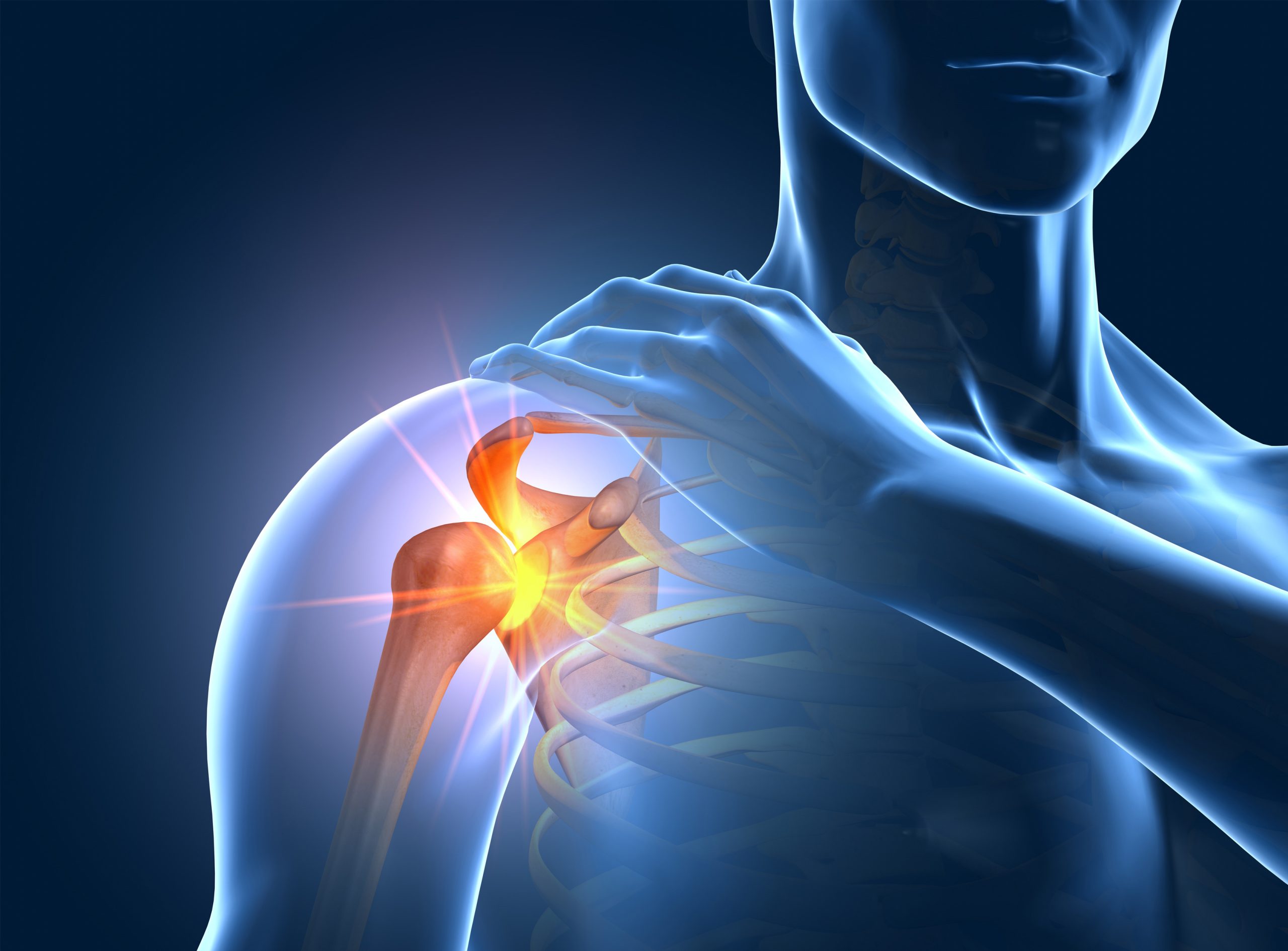 shoulder joint - the source of pain in arthritis of the shoulder