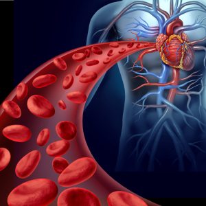 carotid scan, Stroke Scan, Vascular scans