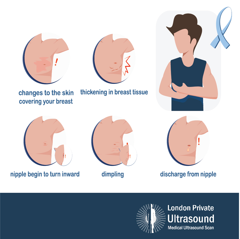 The signs and symptoms of mens breast cancer
