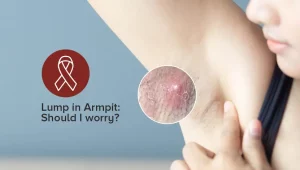 Lump in armpit