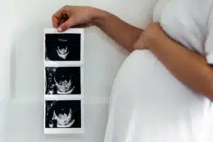 12 Week Scan
