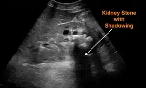 Kidney Imaging
