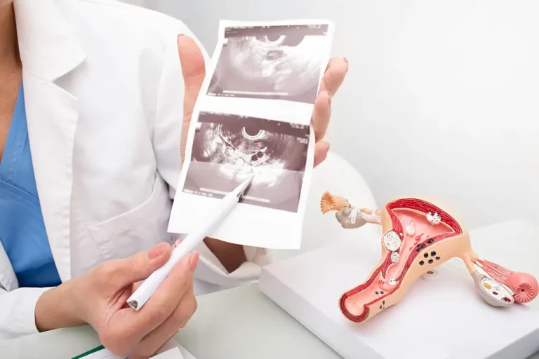 Transvaginal Ultrasound