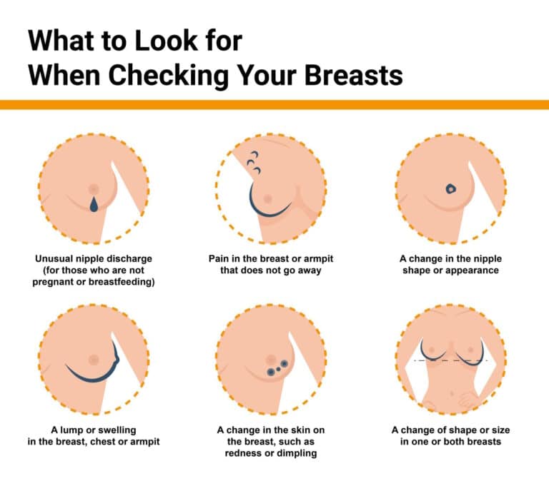 Breast Check