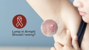 Armpit Lumps