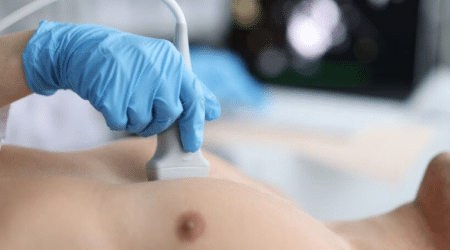 Echocardiogram – Cardiac Ultrasound​