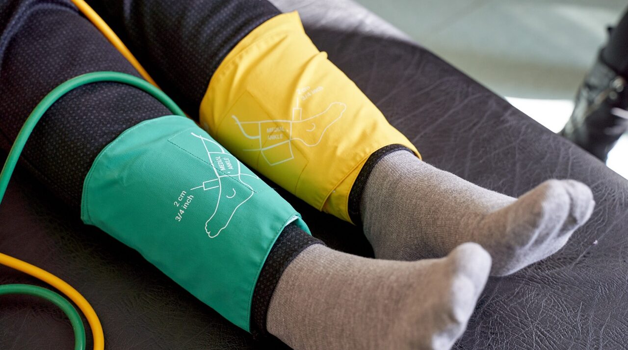 Ankle pressure cuffs used during an ABPI circulation assessment