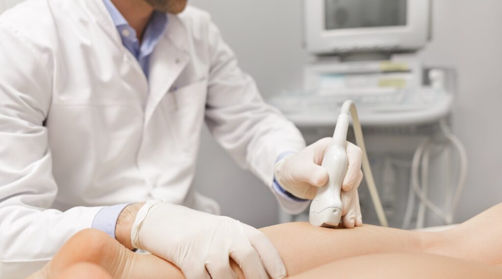Varicose Vein One Limb Ultrasound Scan