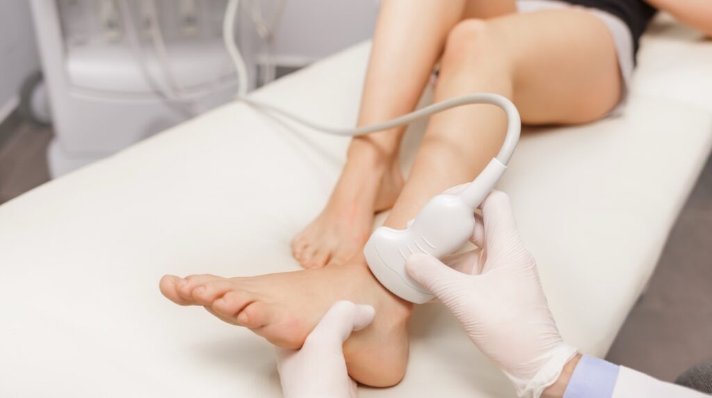 leg ultrasound scan