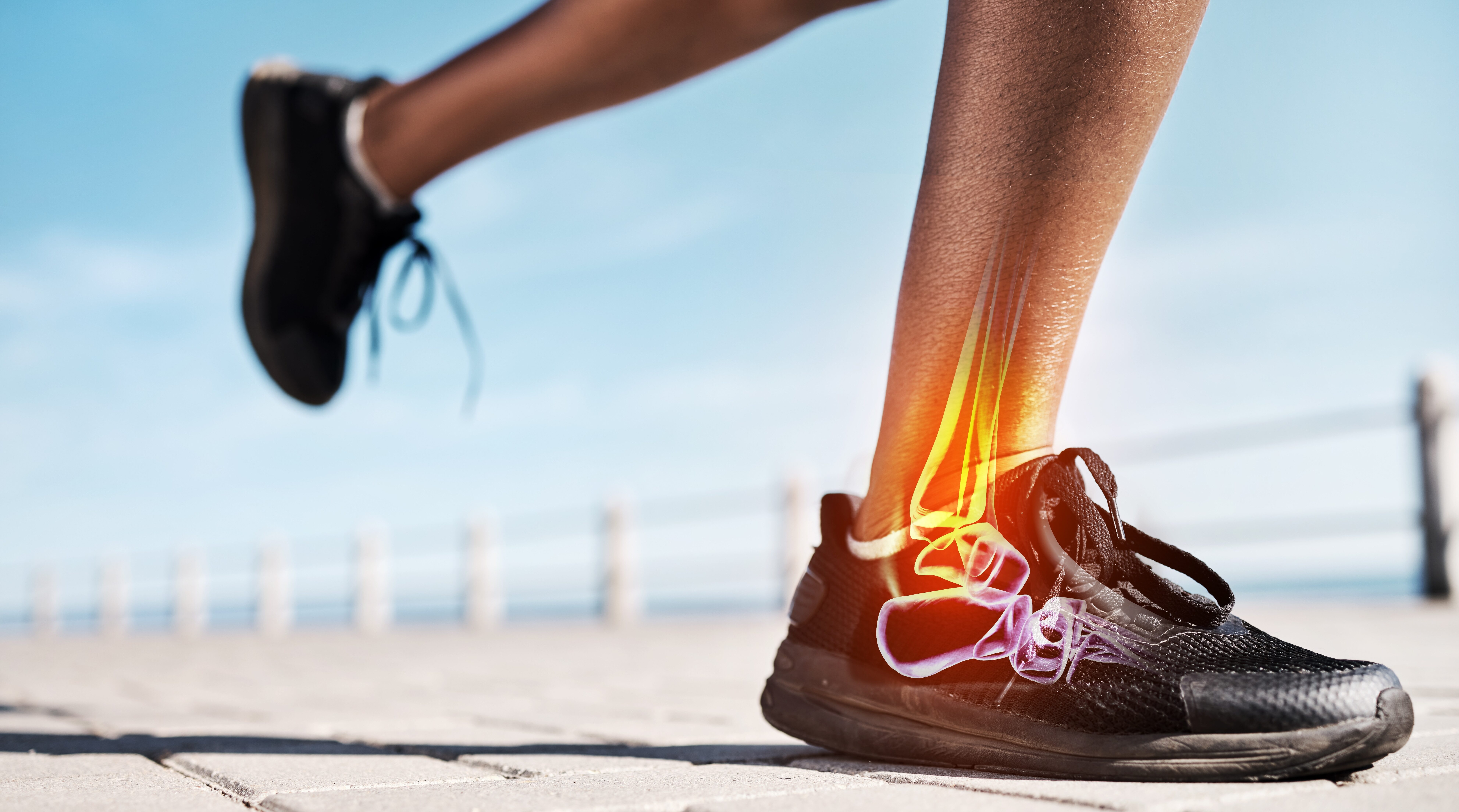 foot ultrasound scan