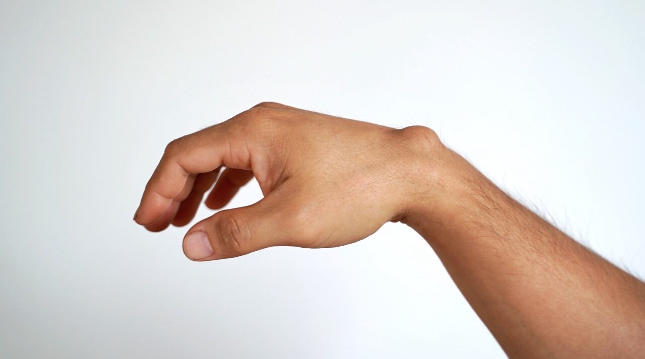 Lumps and Bumps Soft Tissue