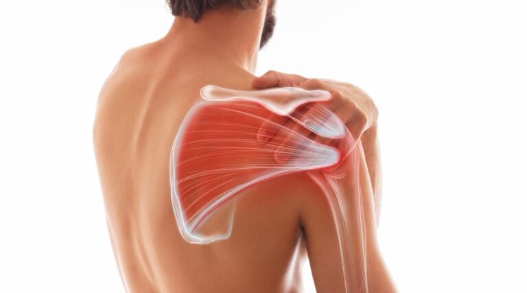 Shoulder Ultrasound Scan -MSK