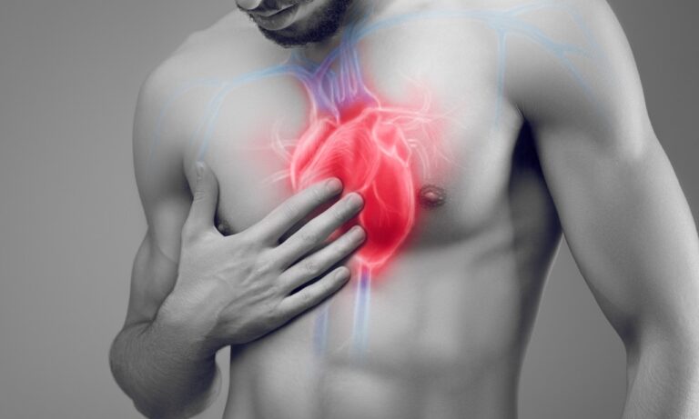 Stroke Risk & Heart Health Screening | London Cardiologist