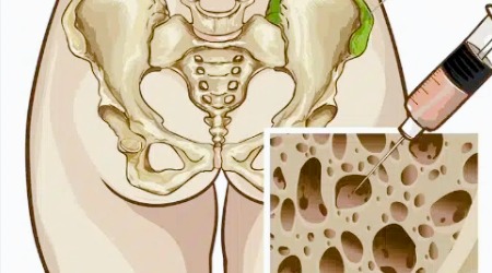 Joint Pain Clinic | Private Ultrasound Scans and Health Checks | London Private Ultrasound