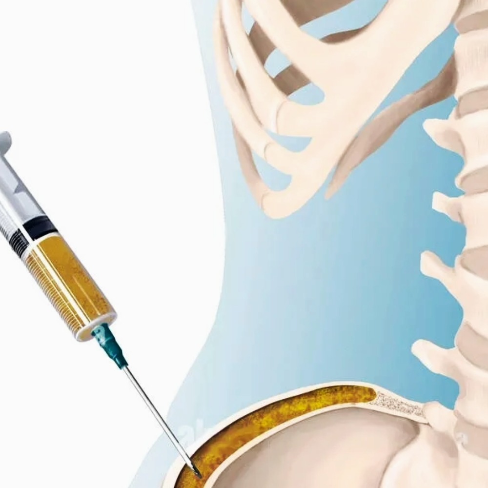 Joint Pain Clinic | Private Ultrasound Scans and Health Checks | London Private Ultrasound